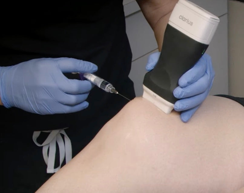 Ultrasound-guided injections